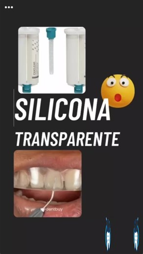 EXACLEAR es un innovador material de silicona transparente que satisface las necesidades de casos estéticos exigentes y facilita la obtención de unos resultados fantásticos. Su absoluta transparencia lo hace especialmente eficaz en situaciones clínicas complejas. Porque el tiempo también importa Después de solo 2 minutos en el interior de la cavidad bucal, la impresión se fragua y se puede extraer. Cuando se trabaja en un modelo, el fraguado del material se produce en menos de 7 minutos. #esteti