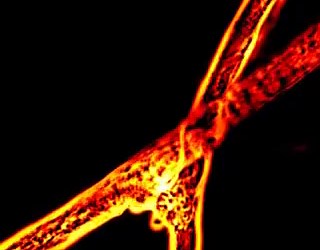 Each tubule of fungal root systems is about one-tenth the width of a human hair. New technology has allowed scientists to glimpse nutrients flowing through them for the first time. It’s revolutionizing the field. https://t.co/Gbro2R2d32