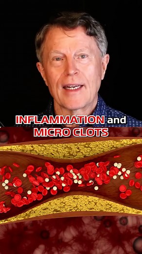 How to use Aspirin to Clean Arteries | Dr. Ford Brewer