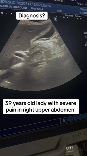 #draliabangashultrasoundclinic #MedicalTikTok #RadiologyExperts #LearningRadiology #foryou