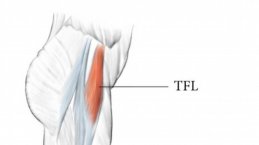How to Fix Pain in the Tensor Fasciae Latae (TFL muscle)