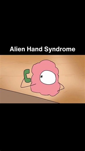 Alien Hand Syndrome Explained: When Your Hand Moves on Its Own 👋🧠