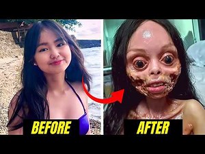 Plastic Surgery Changed Them Forever | 12 Humans Before And After Plastic Surgery