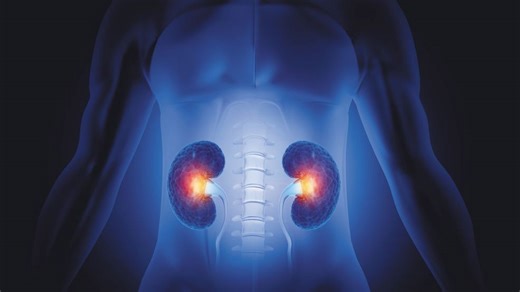 Tampa General opens first comprehensive kidney stone clinic in Palm Beach County