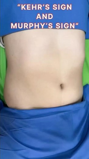 Kehr’s sign & Murphy’s sign : differences in 60 seconds