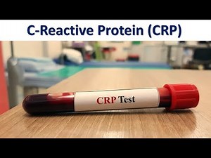 C Reactive Protein (CRP)