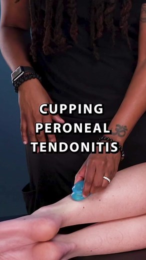23K views · 644 reactions | Cupping Peroneal Tendonitis...
