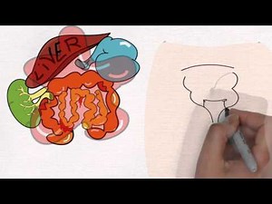 Animation: What is Pseudomyxoma Peritonei (PMP)?