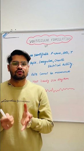 Ventricular Fibrillation in 30 Seconds ⚡| Deadliest ECG Rhythm! #ecgreading #ecg #ekg #cardiology