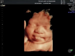 15K views · 487 reactions | How cute is this chubby, 37 week old babe sticking her little tongue out?!?!? | The 4D Ultrasound Lady | Facebook