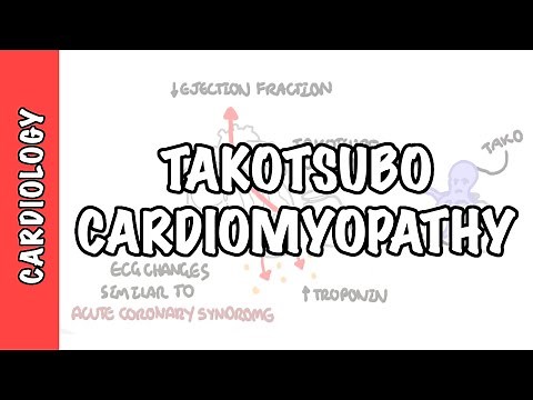 Takotsubo Cardiomyopathy (Broken heart syndrome) - pathophysiology, diagnosis and treatment