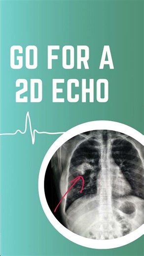 💓 2D Echo – See Your Heart in Motion!