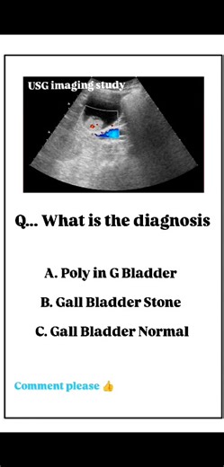 3.8K views · 18 reactions | What is the diagnosis #ultrasound | Usg Imaging Study | Facebook