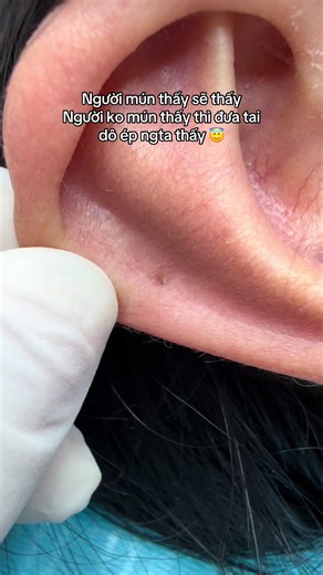 Trendy Ear Piercing Styles You Need to Know