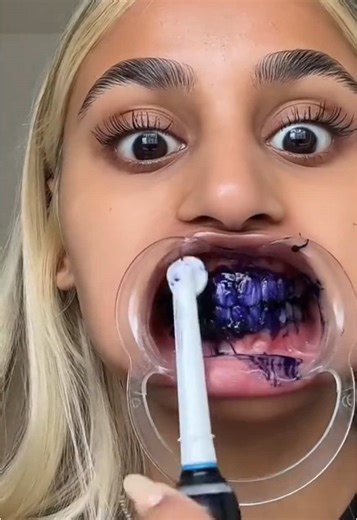 Clareamento Dental: Como Clarear os Dentes em Casa