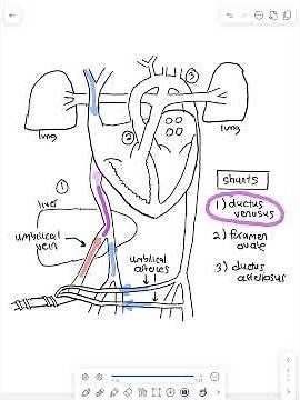Fetal cardiac anatomy: ductus venosus
