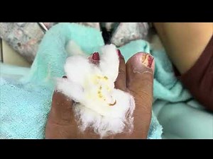 How to Safely Cut and Clean an Ingrown Nail #nails #nailcare