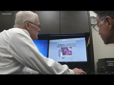 The alternative to hernia surgical mesh implants | KVUE