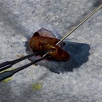 Video: Evaluation of a Reliable Biomarker in a Cecal Ligation and Puncture-Induced Mouse Model of Sepsis