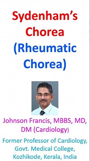 Sydenham’s Chorea (Rheumatic Chorea)