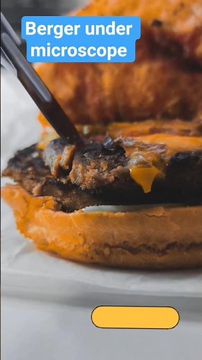 Bacteria Up Close: Microscopic World Revealed!".