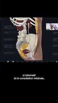 Colique Nephrétique : explications avec Complete Anatomy