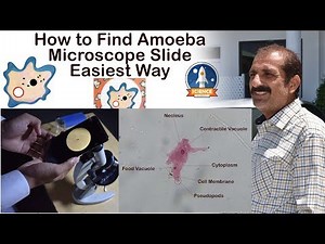 How To make Ameba slid || Microscope Slide || Easiest Way