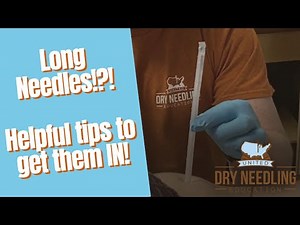 LONG NEEDLES! Helpful dry needling tips to insert large and long needles