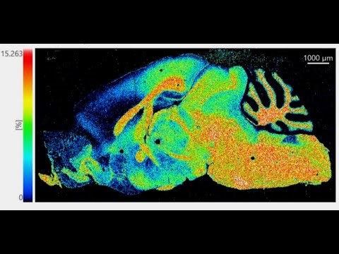 Mass Spectrometry Imaging