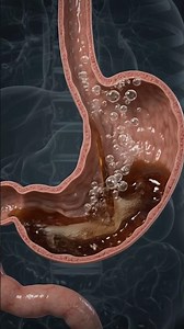 What Happens Inside Your Stomach After You Eat? | 3D Anatomy #intestinal #usa #usashorts