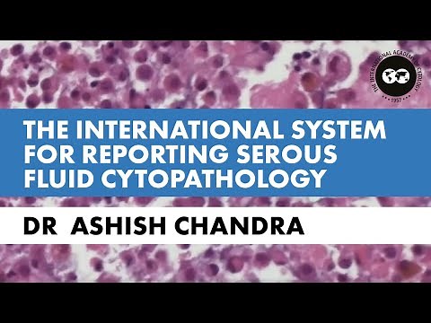 Dr. Ashish Chandra: The International System for Reporting Serous Fluid Cytopathology (2020)