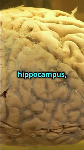 Inside the Human Brain: How Are Memories Made? 🧠✨ Unlocking the Secrets of Memory #memories #brain
