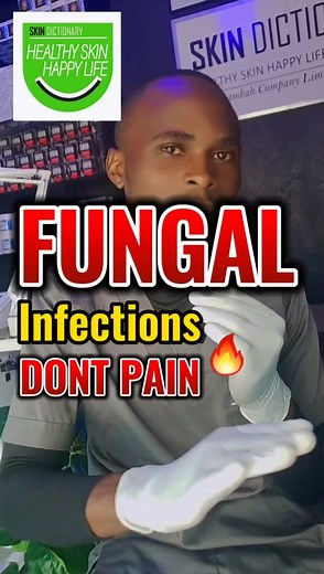 Fungal infections can be uncomfortable or itch and they can take weeks or months to effectively treat. If you think you have a fungal infection, see your doctor. They can diagnose the type of infection and recommend an appropriate antifungal medication.#fungalinfection #tineacapitis #tineaversicolor #skindictionary #uganda @Skin Dictionary