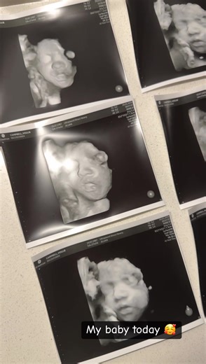 Beautiful 4D Baby Scan Experience at Week 28