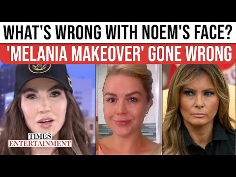 Kristi Noem's 'BOTOX FAIL' Shocks America; 'MAR-A-LAGO FACE' Blows Up As Plastic Surgeon 'Reacts'