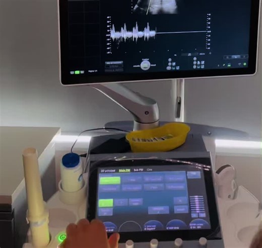 Momentos que te marcan para siempre 💜 Nuestra futura mami escuchando el corazon de su bebe por priemra vez😍 Contamos con servicios de comtrol prenatal #medicinareproductiva #controlprenatal #ultrasonido