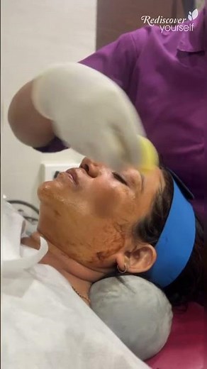 What REALLY Happens After Your First Medi-Peel 👀