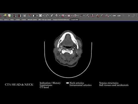 [CT] CTA Head and Neck | Search Pattern