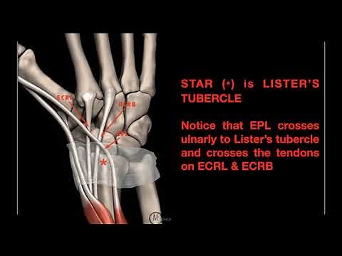 Wrist Extensor Zones EXPLAINED