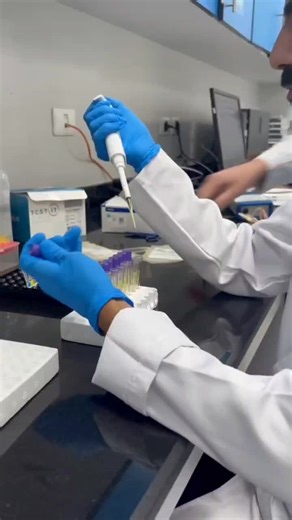 Learning the ABO grouping card method at Blood Bank of Al Nas Hospital | mohamed Talaat posted on the topic | LinkedIn