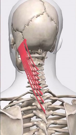 “Splenius capitis muscle tension lines”