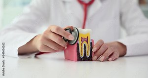 Dentist touches artificial model of tooth with stethoscope. Doctor demonstrates decayed tooth from lack of necessary care slow motion
