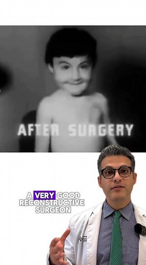 Reconstructive Surgical Techniques | Avance Plastic Surgery Institute: Dr. Erez Dayan