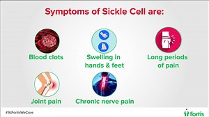 1.3K views · 164 reactions | Sickle cell is a rare blood disorder that contorts red blood cells into a sickle shape. As a result of this disease, the cells can die early, leaving a shortage of RBCs and blocking blood flow. To know more about blood-related disorders, visit our all-new BMT unit in Central Mumbai or go visit www.fortismumbai.com for more information. #AtFortisWeCare #ARayOfHope | Fortis Mumbai | Facebook