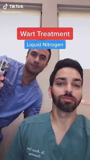 Wart Treatment #dermatologist #wart #warttreatment #ShowAndTell #learnontiktok #liquidnitrogen