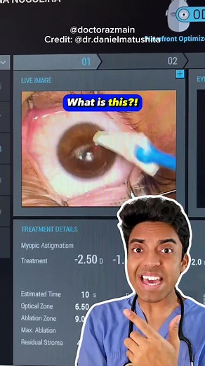Understanding LASIK Eye Surgery: Doctor's Reaction and Explanation