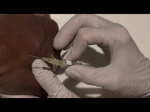 How to Insert an IV Like a Pro | Step-by-Step Nursing Skill Demo