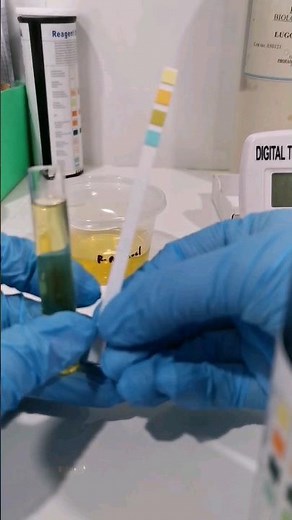 Urinalysis Urine Analysis Procedure #laboratory #mls #cls #medtechstudent #urine #urinetest #urine