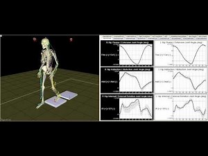 Gait Motion Analysis Technology - Motion Analysis