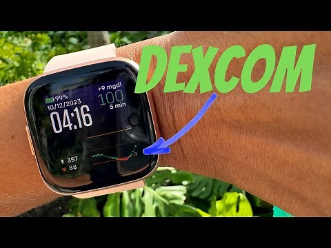 Dexcom To Fitbit Watch Tutorial - Including How To Set Up The Watch